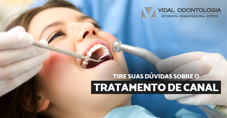 23 - Vidal_TRATAMENTO DE CANAL