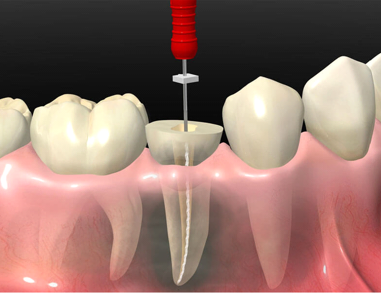 vidalsitetra1111111tamentos-04-02[1]