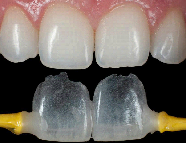 vidalsitetra1111111tamentos-04-03[1]