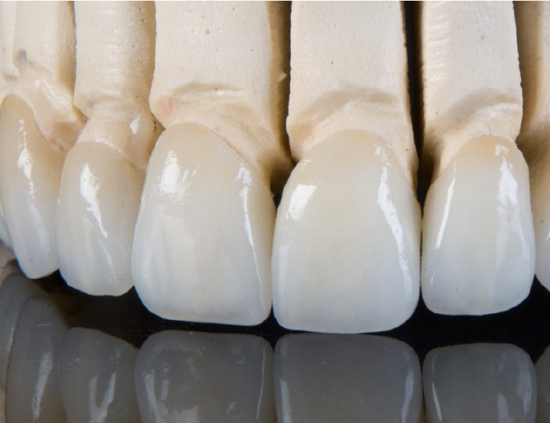 vidalsitetra1111111tamentos-04-06[1]